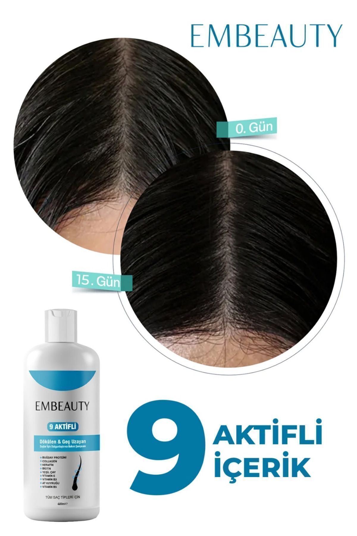 شامپو ضد ریزش مو حاوی کلاژن و کراتینه Embeauty - مجموعه 2 عددی
