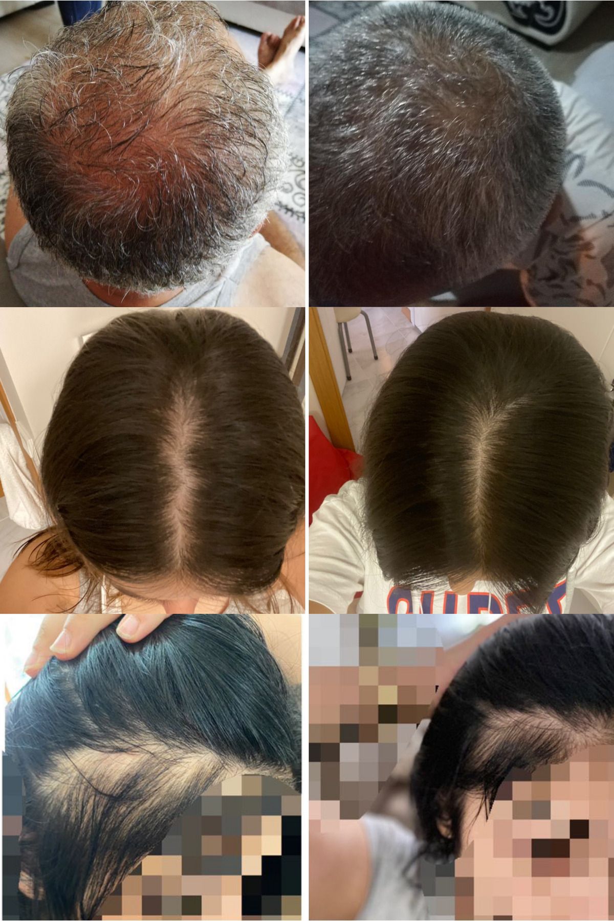 ست سرم و شامپو ضد ریزش موهای خشک DIAMOND HAIR
